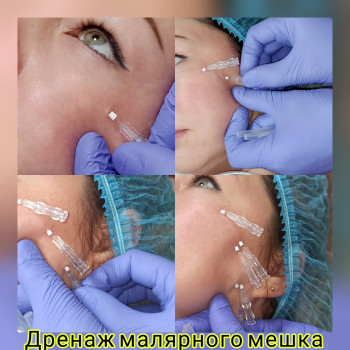 Наталия Мартыненко, Сумы Фото - 20