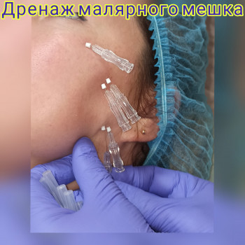 Наталия Мартыненко, Сумы Фото - 21