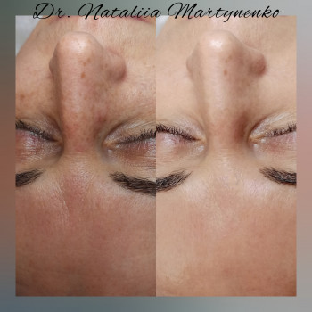 Наталия Мартыненко, Сумы Фото - 22