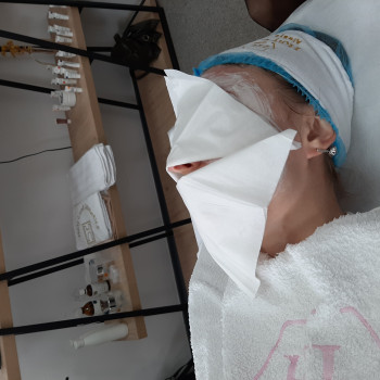 Атравматическая чистка лица
                    Косметолог Юлия Чернігів