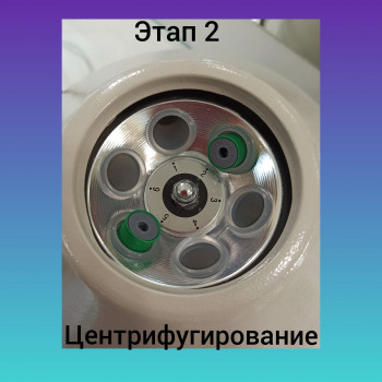 Плазмоліфтинг
                    Врач-косметолог Наталия Сумы