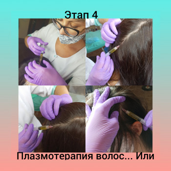 Плазмоліфтинг
                    Врач-косметолог Наталия Сумы