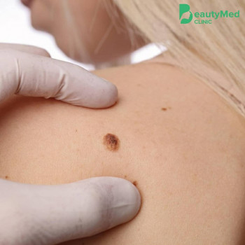 Beautymed Clinic, Запоріжжя Фото - 64