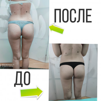 Массаж ручной
                    Массажист Анастасия Андреевна Кривонос Мариуполь