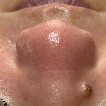 Виктория Рощик, Кривий Ріг Фото - 4