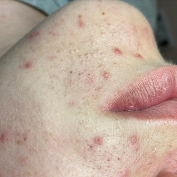 Виктория Рощик, Кривий Ріг Фото - 9