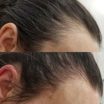 Трихопигментация
                    Лікар-косметолог Юлия Харків