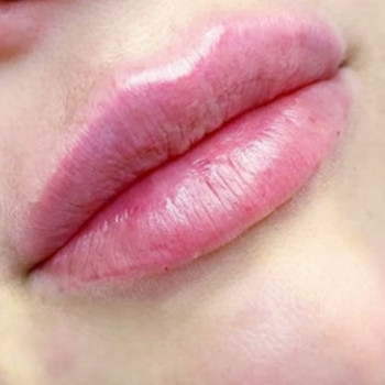 Коррекция губ