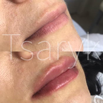 Ірина Царик, Черновцы Фото - 6