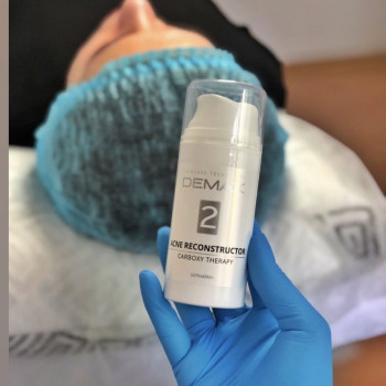 Карбокситерапия