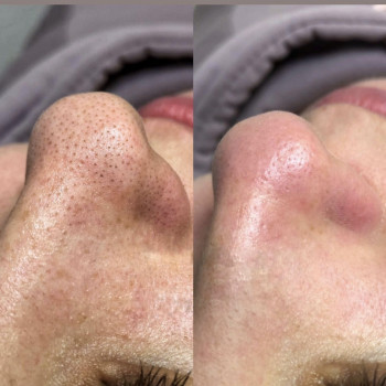 Анна Агапова, Черкассы Фото - 9