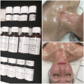 Энзимная терапия (ферментотерапия)
                    Косметолог-инъекционист Яна Черкассы