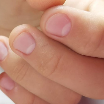 После маникюра, без порезов и пропилов.