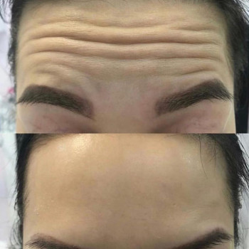 Венеция, Житомир Фото - 80