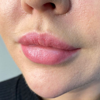 одна процедура удаления - до/после