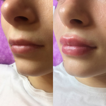 Людмила Грігорян, Одеса Фото - 19