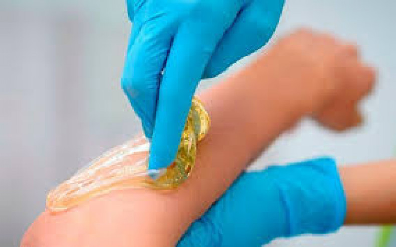 Шугаринг рук Харьков, фото - Косметологический центр Полтавский