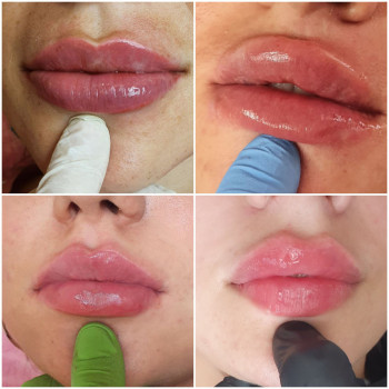 А какую форму выберешь именно ты??