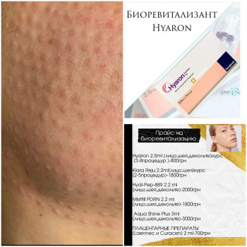 Ксения Степаненко , Одесса Фото - 9