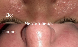 Чистка лица Майстер перманентного макіяжу Юля Харків