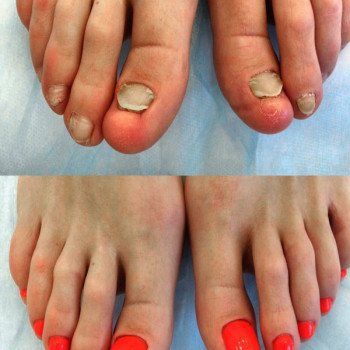 Педикюр женский
                    Салон краси Апраксина Бориспіль