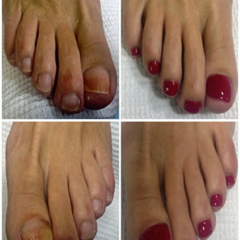 Педикюр женский
                    Салон краси Апраксина Бориспіль