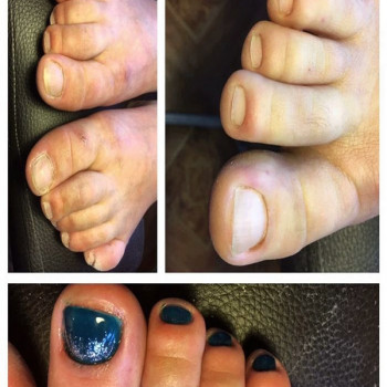 Педикюр женский
                    Салон краси Апраксина Бориспіль