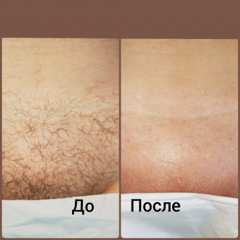 Алла Борзенко , Одесса Фото - 5