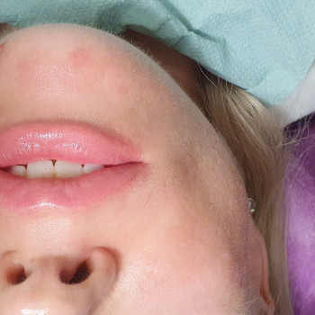 Тетяна Твердохлібенко, Одеса Фото - 16