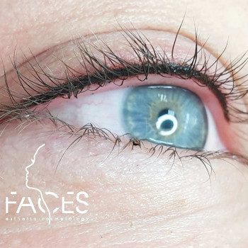 Заполнение межресничного пространства