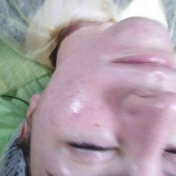 Карбокситерапия
                    Массажист Юлія Киев