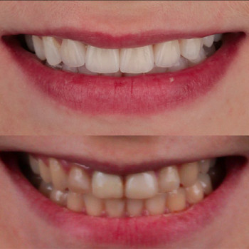 Андрей Туркив , Киев Фото - 5