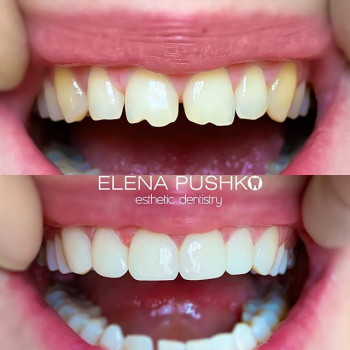 Елена Пушко , Киев Фото - 5