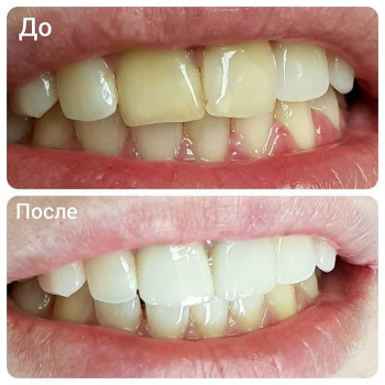 Генри Гукасян , Киев Фото - 5