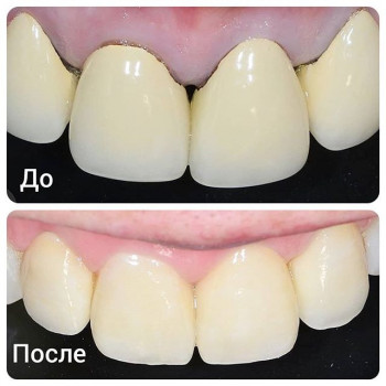 Генри Гукасян , Киев Фото - 6