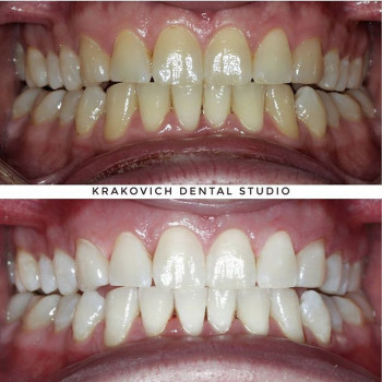 Андрей Кракович , Київ Фото - 5