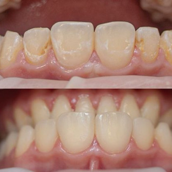 Ярослав Тарасевич , Київ Фото - 5