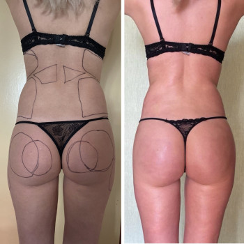 Святослав Ізбенко, Ивано-Франковск Фото - 5