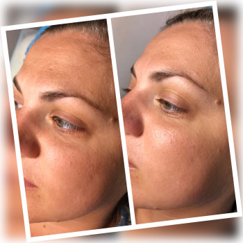 Уходовая процедура с массажем лица