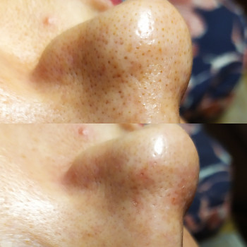 Людмила Чайка, Київ Фото - 17