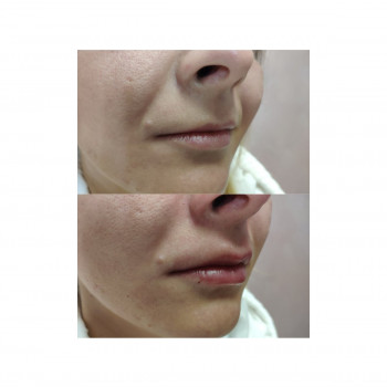 Людмила Чайка, Київ Фото - 24