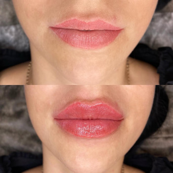 Екатерина Привал , Суми Фото - 5