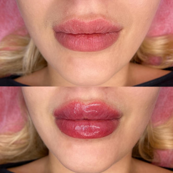 Екатерина Привал , Суми Фото - 6