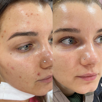 Екатерина Привал , Суми Фото - 8