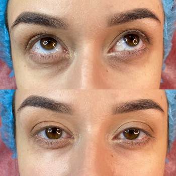 Екатерина Привал , Суми Фото - 9