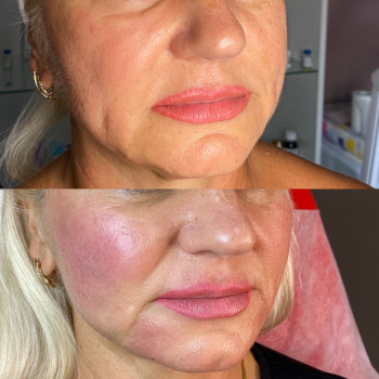 Екатерина Привал , Суми Фото - 10