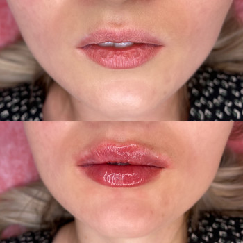 Екатерина Привал , Суми Фото - 11