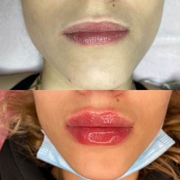 Екатерина Привал , Суми Фото - 14