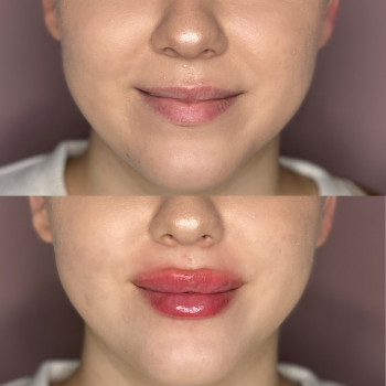 Екатерина Привал , Суми Фото - 15