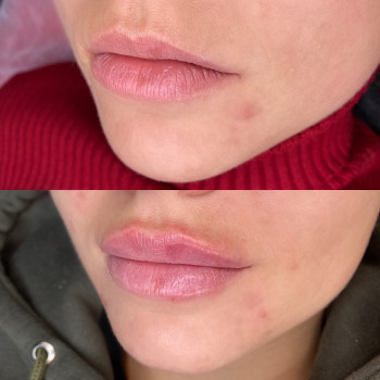 Екатерина Привал , Суми Фото - 17